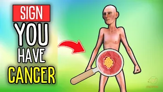 How to Know if You Have Cancer ? | 5 Signs You Shouldn't Ignore !