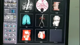 كيف تقوم بعمل فحص مقطعية علي الكتف بطريقة سهلة جدا Ct shoulder