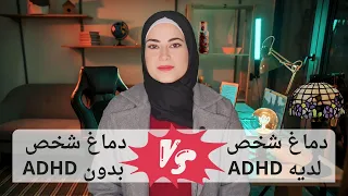 كل ما تريد معرفته عن اضطراب نقص الأنتباه وفرط النشاط ADHD