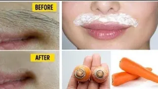 Stop shaving! Here's how to get rid of facial, body and pubic hair permanently.