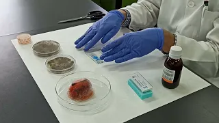 Tinción con azul de lactofenol