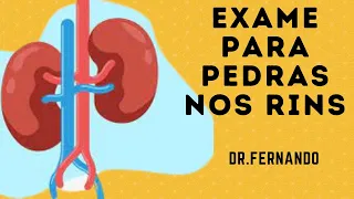 Qual o melhor exame para pedra nos rins??? | Dr.Fernando Leone #Urologista #pedranosrins