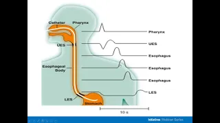 What Every Nurse Needs to Know about High Resolution Manometry