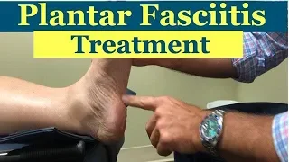 AWESOME treatment for PLANTAR FASCIITIS (foot pain)