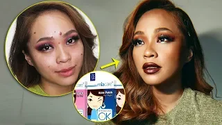 HOW TO COVER ACNE WITH PIMPLE PATCH FOR FLAWLESS MAKEUP | Booya