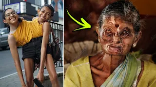 10 Most Odd & Unusual People Who Were Born Different