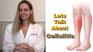 CELLULITIS: Everything You Need To Know! Symptoms. Cause. Risk Factors. Treatment. Prevention.