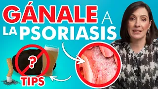 🔴 Si sientes esto tienes PSORIASIS? Es CONTAGIOSA? @drapilarochoa Dermatologa