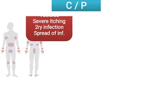 Sarcoptes scabiei (itch mite )..Scabies  الجرب