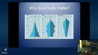 Oxford University surgical lecture: One last question before the operation - just how frail are you?