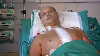 Подробиці першої пересадки механічного серця в Україні