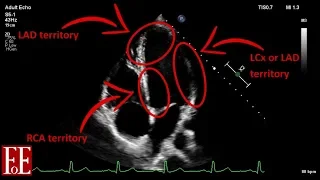 Foundations of Echocardiography: BSE Level 1 Focused Scan