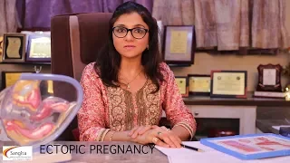 What is Ectopic Pregnancy and how to treat that?