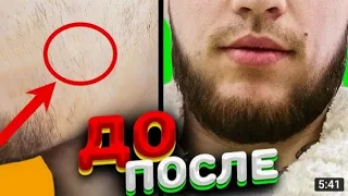 10 самых быстрых способов | Как отрастить бороду   полезных информация