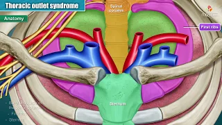 Thoracic outlet syndrome ( Part-1 ) Animation : Introduction , Anatomy , Types , Causes and imaging