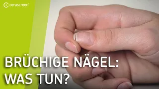 Das solltest Du über Deine Nägel wissen | Brüchige Fingernägel und Nägelpflege