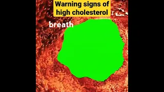 8 important warning signs of high cholesterol #highcholesterol #viral #shorts #health #heart