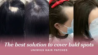 INVISIBLE Cover-up Hair Patches! Perfect for bald spots!