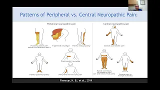 Utilizing Protein Concentration in Your Practice - Jeimylo De Castro, MD