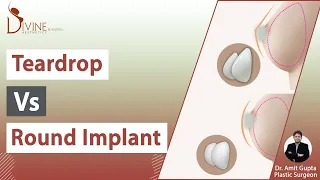 Teardrop vs Round Implant | Teardrop vs. Round Breast Implant Shapes