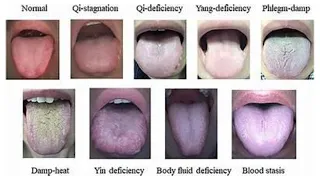 TONGUE COATING COLOR