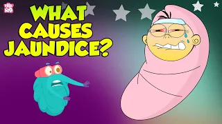 Jaundice | Causes of Jaundice | The Dr Binocs Show | Peekaboo Kidz