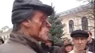 30-11-2013р. Михайлівська площа. Розбите око після розгону майдану