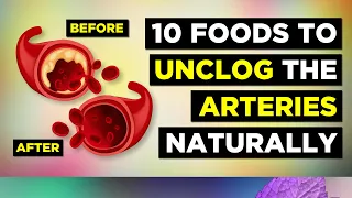 10 Foods That Clean Arteries and Prevent Heart Attacks Naturally