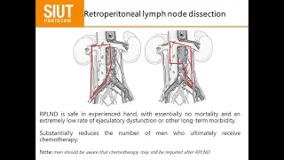 Management of Non Seminomatous Testicular Cancer