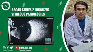 Bscan series 2 localized vitreous pathologies