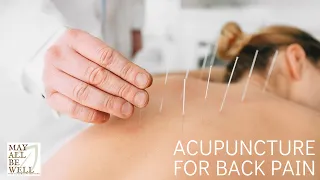 Acupuncture for Back Pain