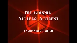 The Goiania Accident | A Short Documentary | Fascinating Horror