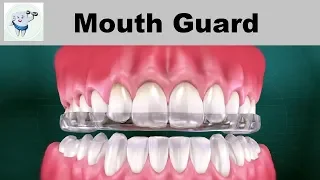 Mouth Guard || Teeth Grinding in Sleep