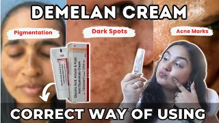 Can We Use Demelan Cream Everyday For Skin Brightening? Pharmacy Brightening Cream Demelan
