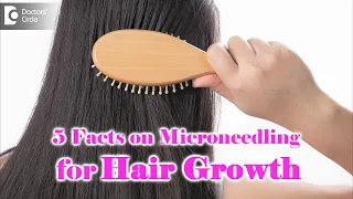 5 Things to Know about Microneedling for Hair Growth - Dr. Divya Sharma|Doctors' Circle