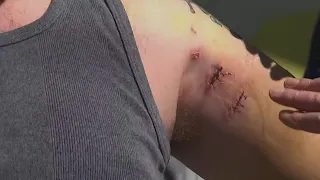 Lawsuit filed after man bitten by police dog during traffic stop