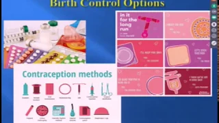 Contraception Options 1/30/19