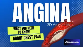 Angina (3D Animation) - Understand Chest Pain from Reduced Blood Flow to the Heart