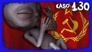 Aleshenka - A shocking case of an alien fetus