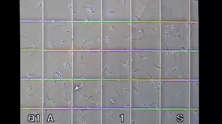 Sperm Count Testing as Viewed Through a Microscope