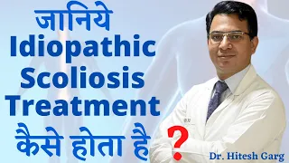 Idiopathic Scoliosis Treatment | Explained in Hindi