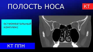 Лучевая анатомия остиомеатального комплекса и полости носа