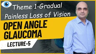 Open Angle Glaucoma Lecture 5