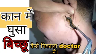 कान में घुसा बिच्छू। || आखिर doctor ने कैसे निकाला बिच्छु को । 😱😱 #shorts