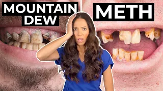 Meth Mouth or Mountain Dew Mouth... Which is WORSE?