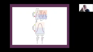 EXP3250 Hearing