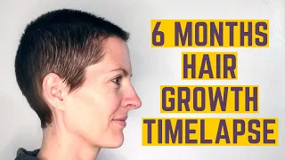 6 Months Hair Growth Time Lapse After Shaving My Head