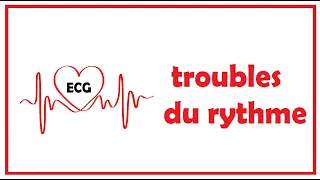 troubles du rythme