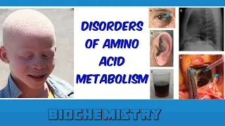 disorders of amino acid metabolism