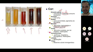 ANÁLISE CLÍNICA DO EXAME DE URINA. SAIBA COMO REALIZAR E INTERPRETAR O EAS COMO VOCÊ NUNCA VIU ANTES